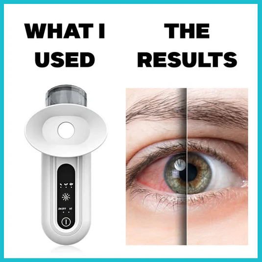 Eye HydraPro™ - Instant Dry Eye Relief Steam Therapy Wand